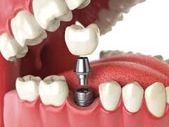 Dental Wizz Clinique - Clinica de stomatologie functionala