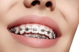 Dental Wizz Clinique - Clinica de stomatologie functionala