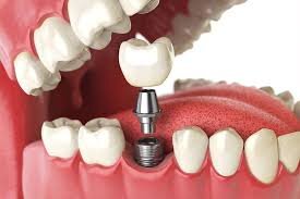 Dental Wizz Clinique - Clinica de stomatologie functionala