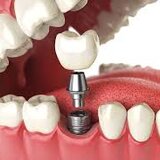 Dental Wizz Clinique - Clinica de stomatologie functionala