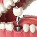 Dental Wizz Clinique - Clinica de stomatologie functionala